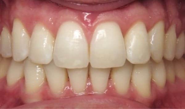 After Lusk Orthodontics