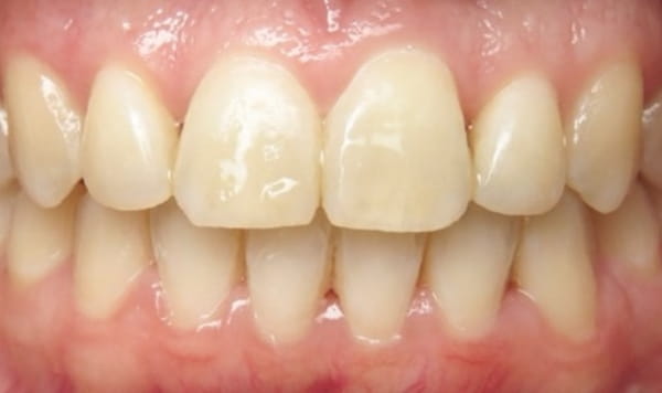 After Lusk Orthodontics