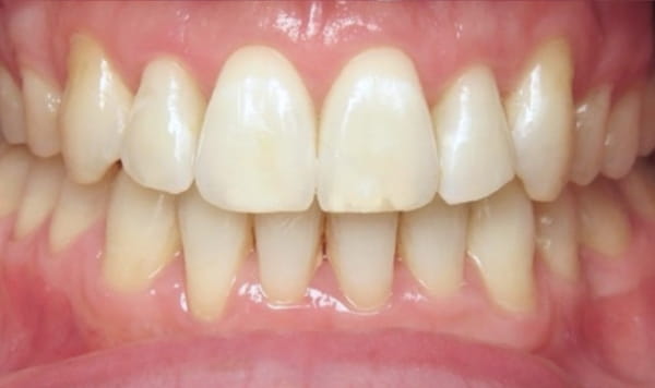 After Lusk Orthodontics