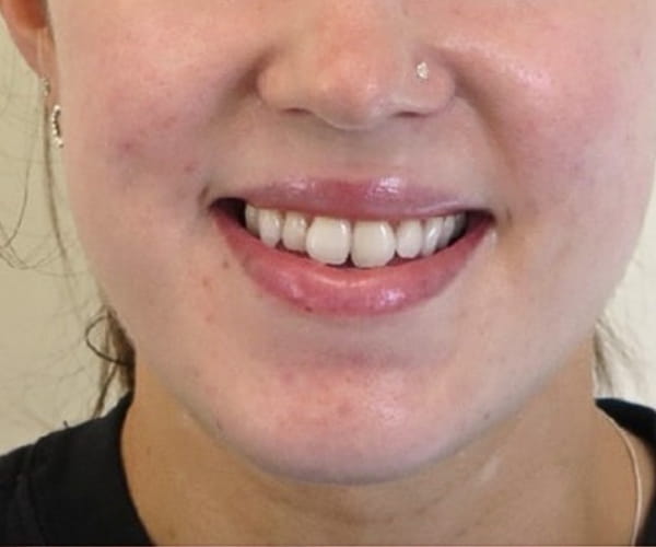 Before - Lusk Orthodontics