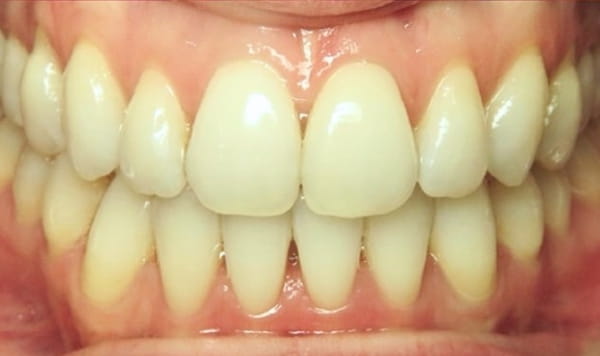 After Lusk Orthodontics
