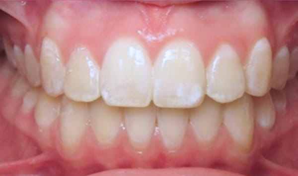 After Lusk Orthodontics