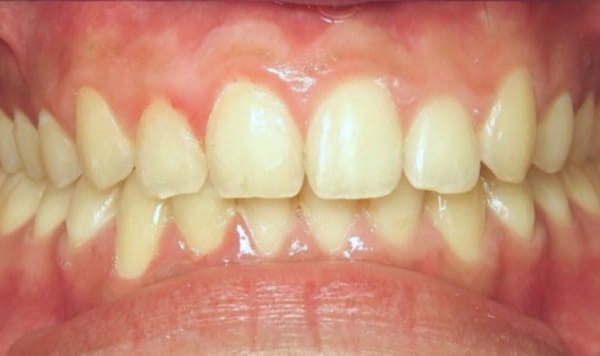 After Lusk Orthodontics