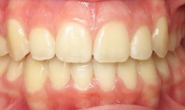After Lusk Orthodontics