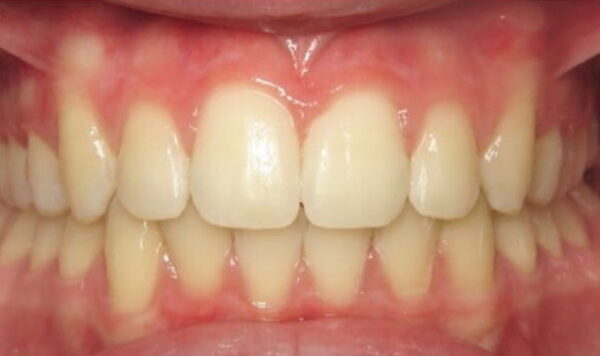 After Lusk Orthodontics