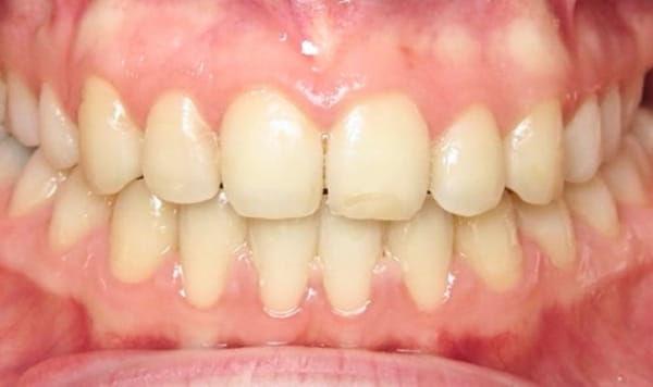 After Lusk Orthodontics