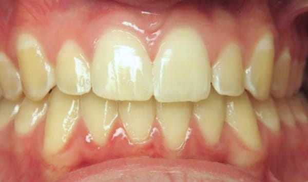 After Lusk Orthodontics