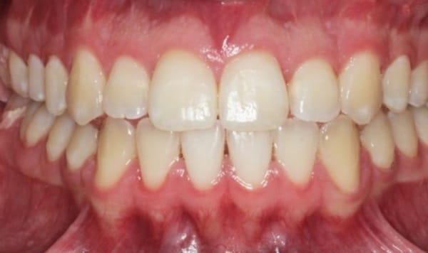 After Lusk Orthodontics