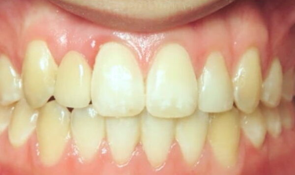 After Lusk Orthodontics