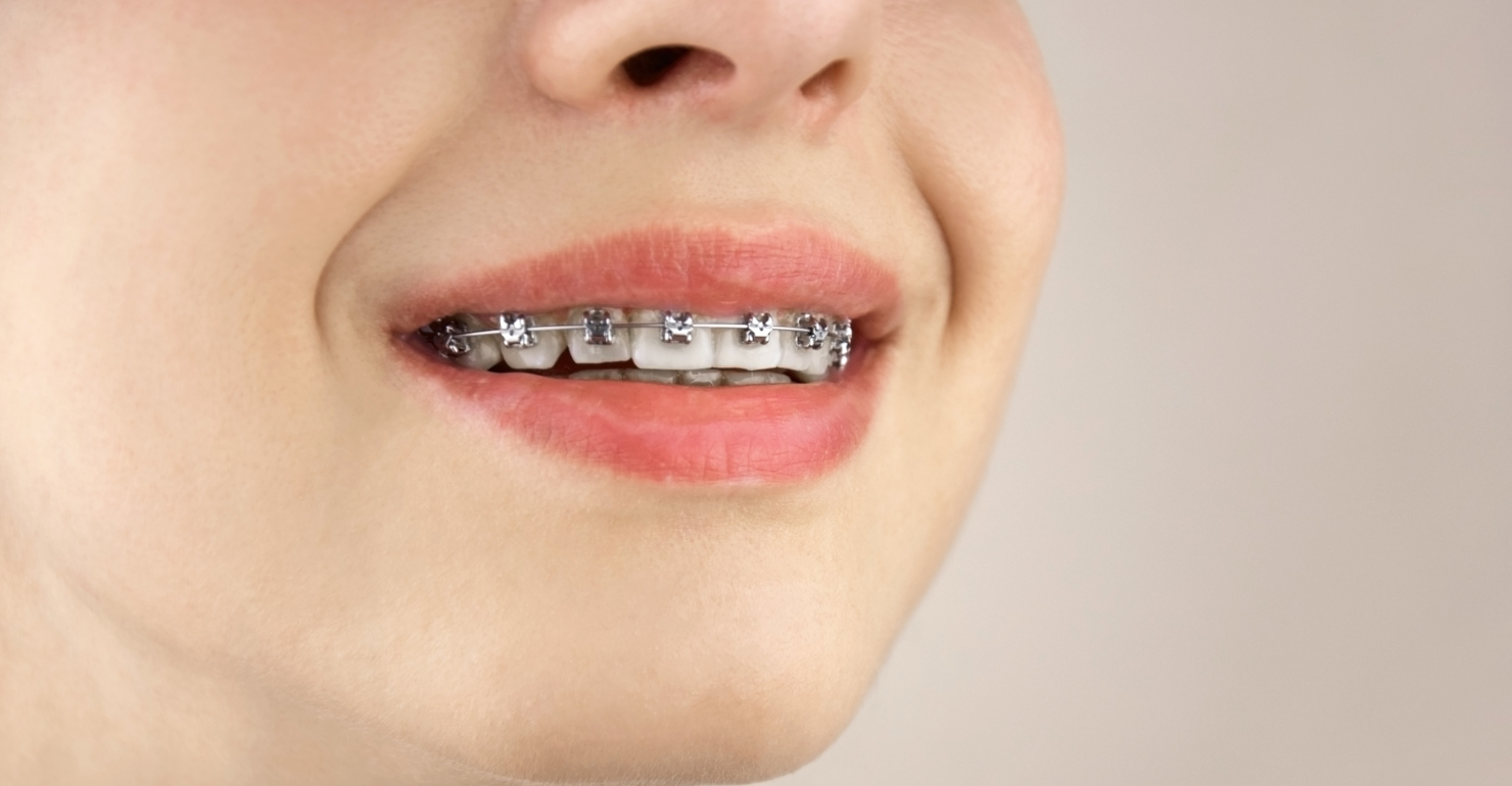 Lusk Orthodontics