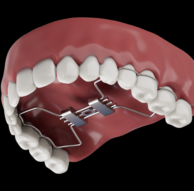 Blog -Lusk Orthodontics